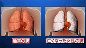 奇跡体験 アンビリバボー 解剖医が体験した不可解な事件 遺体からのメッセージ フジテレビ 奇跡体験 アンビリバボー 解剖医が体験した不可解な事件 遺体からのメッセージ フジテレビ