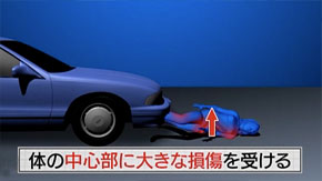 奇跡体験 アンビリバボー 解剖医が体験した不可解な事件 遺体からのメッセージ フジテレビ
