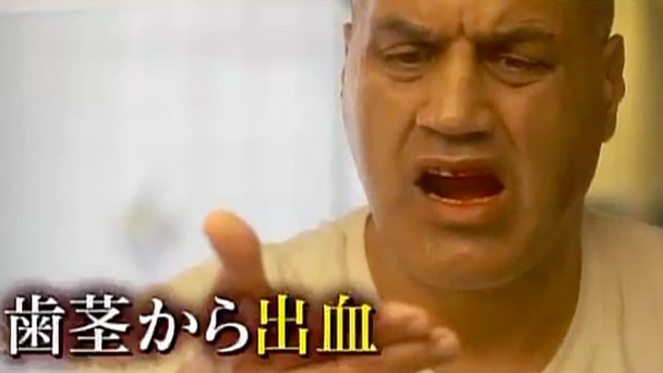 奇跡体験！アンビリバボー：医師VS患者の闘い 自分の細胞は誰のもの 