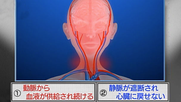 奇跡体験 アンビリバボー 実録 法医学ミステリー 遺体に隠された死の真相 フジテレビ