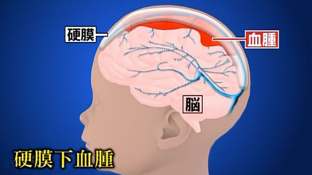 奇跡体験 アンビリバボー 実録 解剖医が明かす事件の真相 フジテレビ 奇跡体験 アンビリバボー 実録 解剖医が明かす事件の真相 フジテレビ
